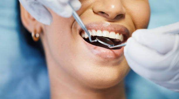 Best Emergency Denture Repair in Ferndale, MI