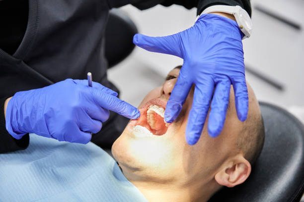 Best Emergency Dental Care for Broken or Chipped Teeth in Ferndale, MI